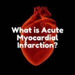 What is Acute Myocardial Infarction