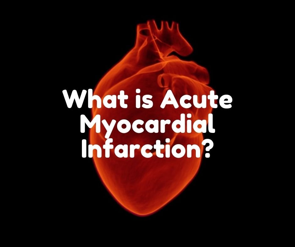 What is Acute Myocardial Infarction