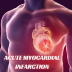 Acute Myocardial