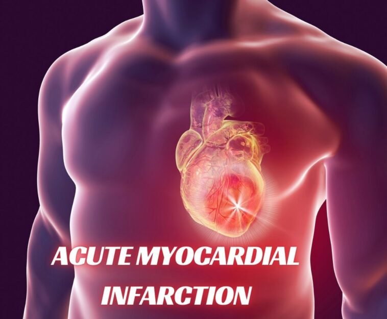 Acute Myocardial