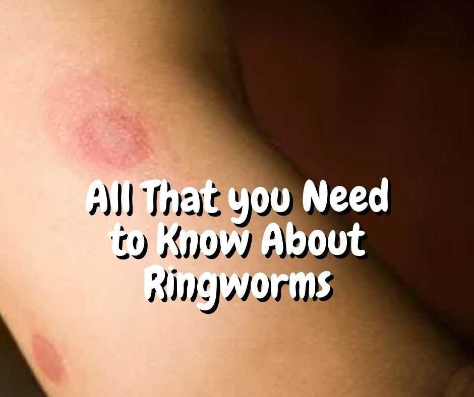 ringworms on humans