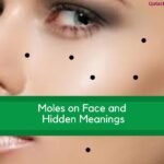 Moles on Face & Their Hidden Meanings